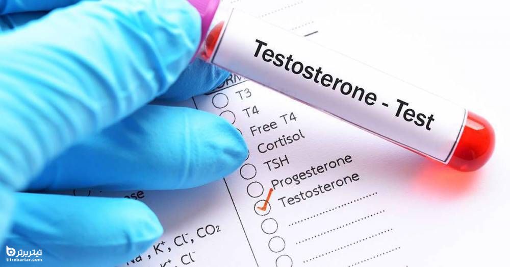 علت‌های کمبود تستوسترون در مردان