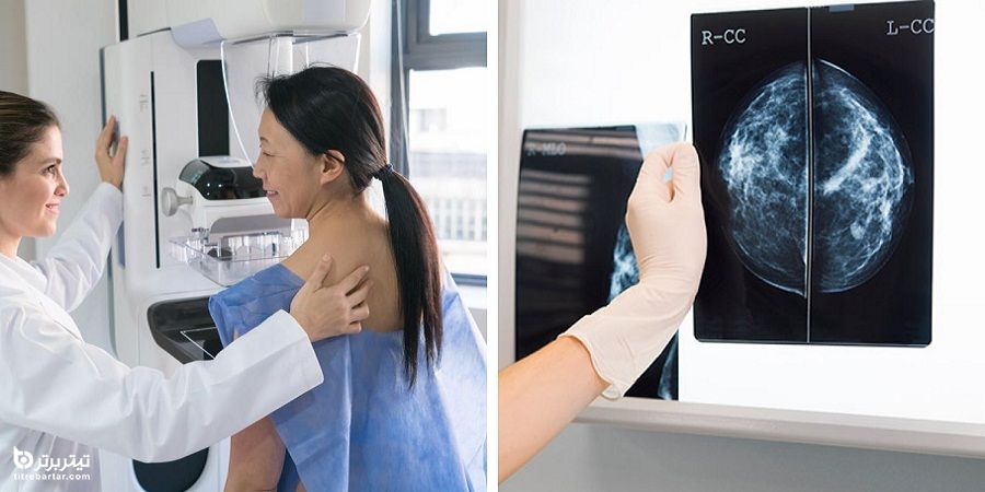 مزایای ماموگرافی چیست؟