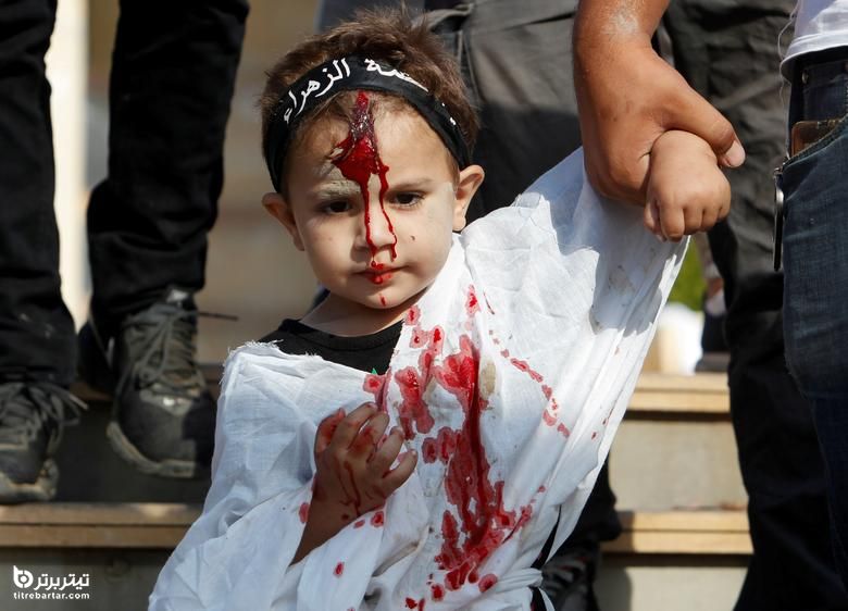 تصویری از یک کودک در حالیکه صورتش در خون است در مراسم راهپیمایی مذهبی به مناسبت عاشورا در نباتیه ، جنوب لبنان