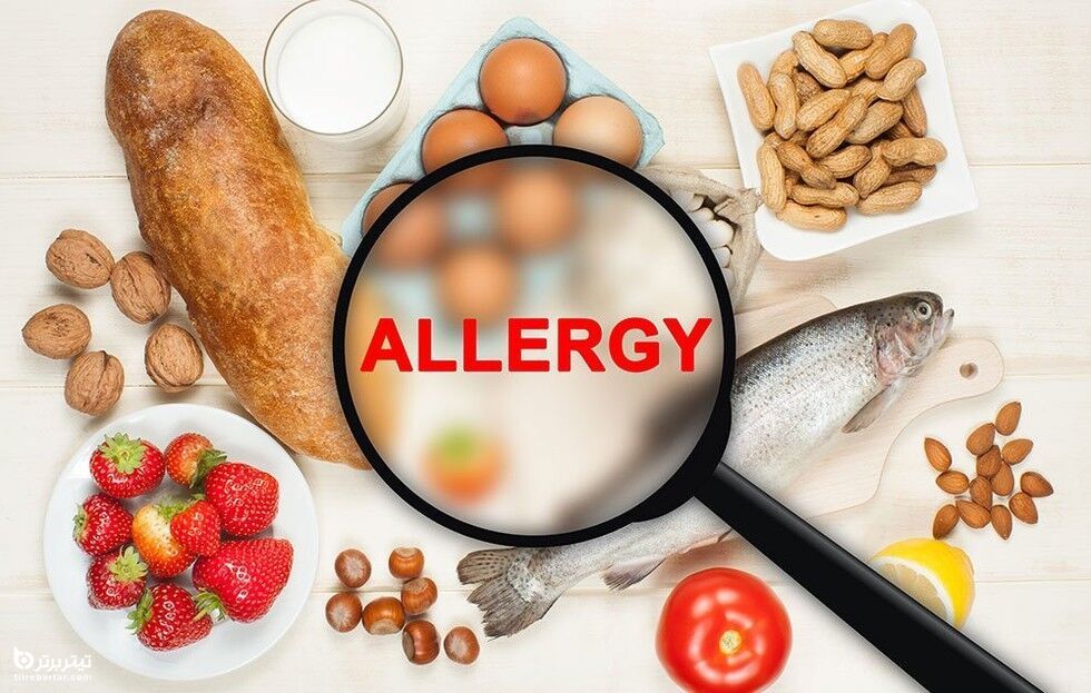 آلرژی غذایی چیست؟