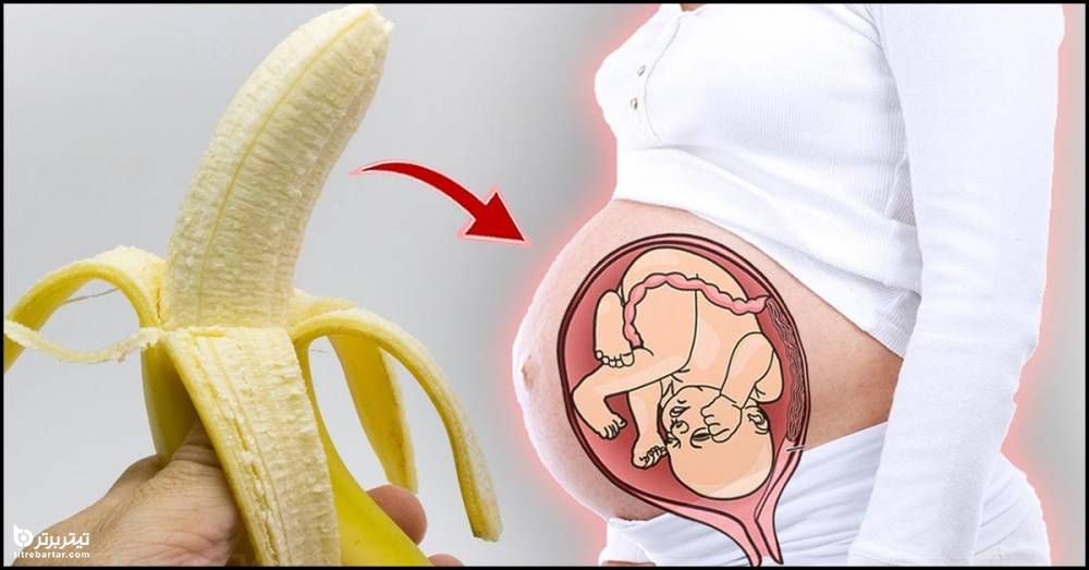 اقدامات احتیاطی هنگام خوردن موز در دوران بارداری