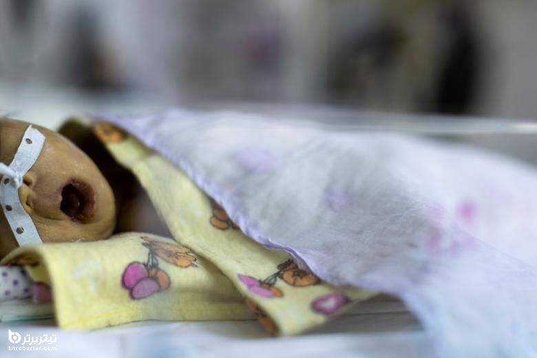 تصاویر شفاخانه اطفال کابل با فروپاشی سیستم صحی افغانستان