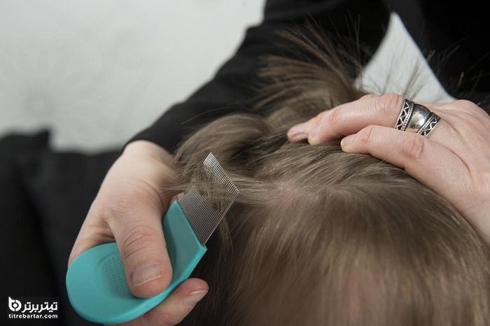 درمان‌های خانگی ساده برای شپش مو برای کودکان و بزرگسالان