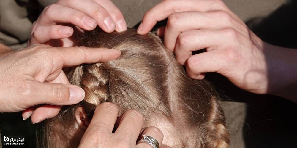 چگونه از ورود شپش به موهایمان جلوگیری کنیم؟