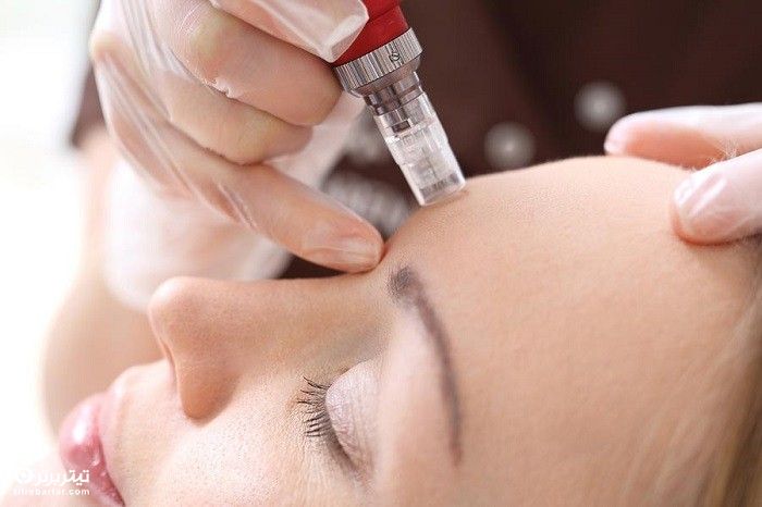 مراقبت های پس از میکرونیدلینگ: بایدها و نبایدها