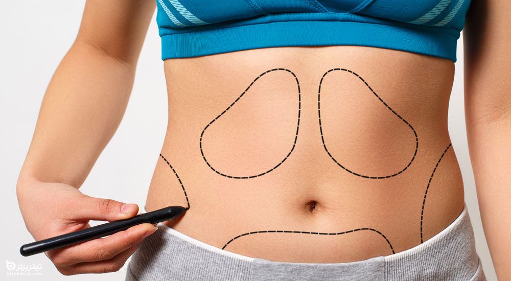 روش های جراحی از بین بردن جای زخم