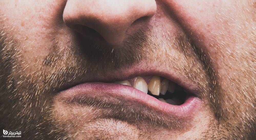 چه چیزی باعث دندان قروچه می شود؟