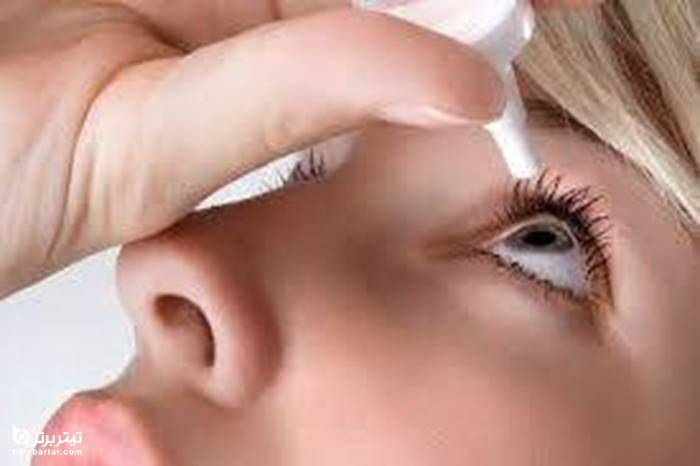 راه پیشگیری یا درمان خشکی چشم