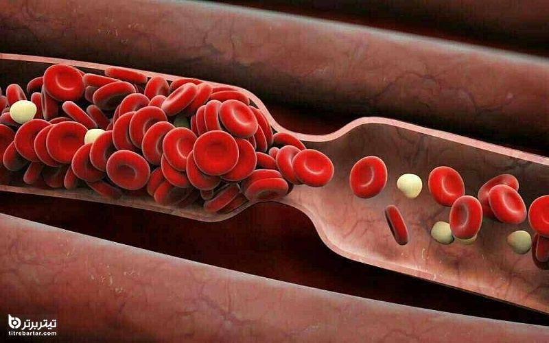عوارض افزایش یا کاهش گلبول های قرمز خون
