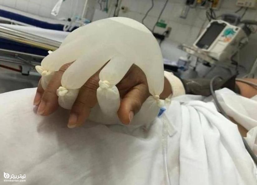 یک پرستار برزیلی با خلق دستان مصنوعی به بیماران در مبارزه با ویروس کرونا کمک می‌کند 