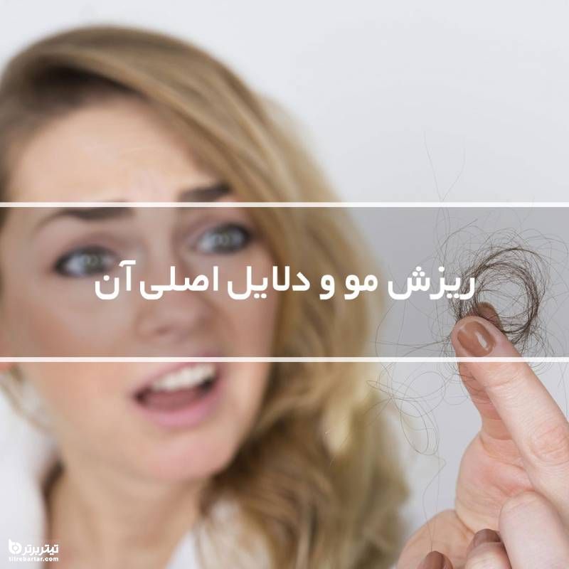دلایل ریزش مو در مردان و زنان