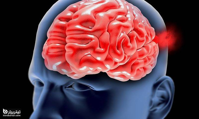 آسیب مغزی چیست؟