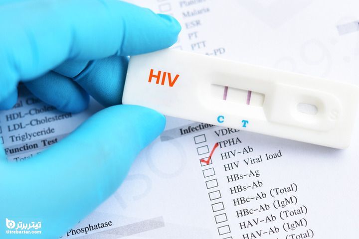راه های انتقال ویروس HIV کدامند