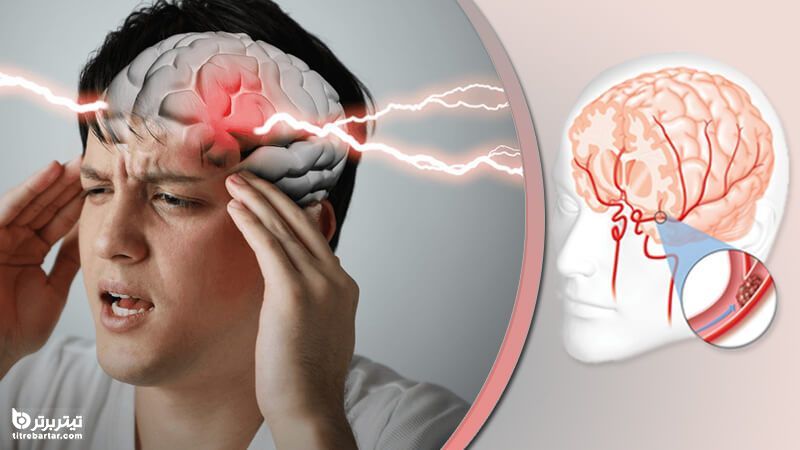 علل بروز سکته مغزی چیست؟