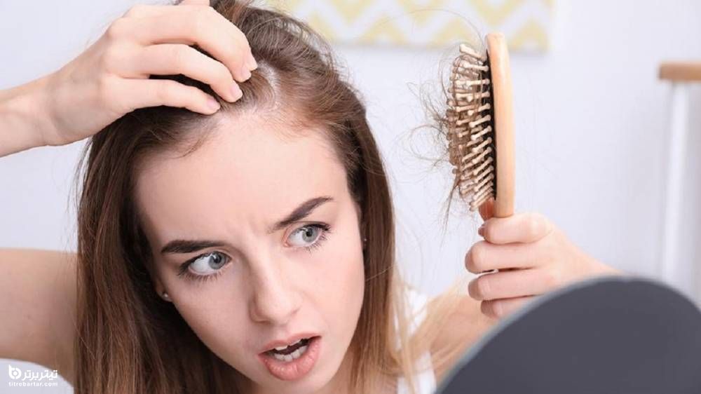 شایعترین نشانه‌ها و علائمی ریزش مو