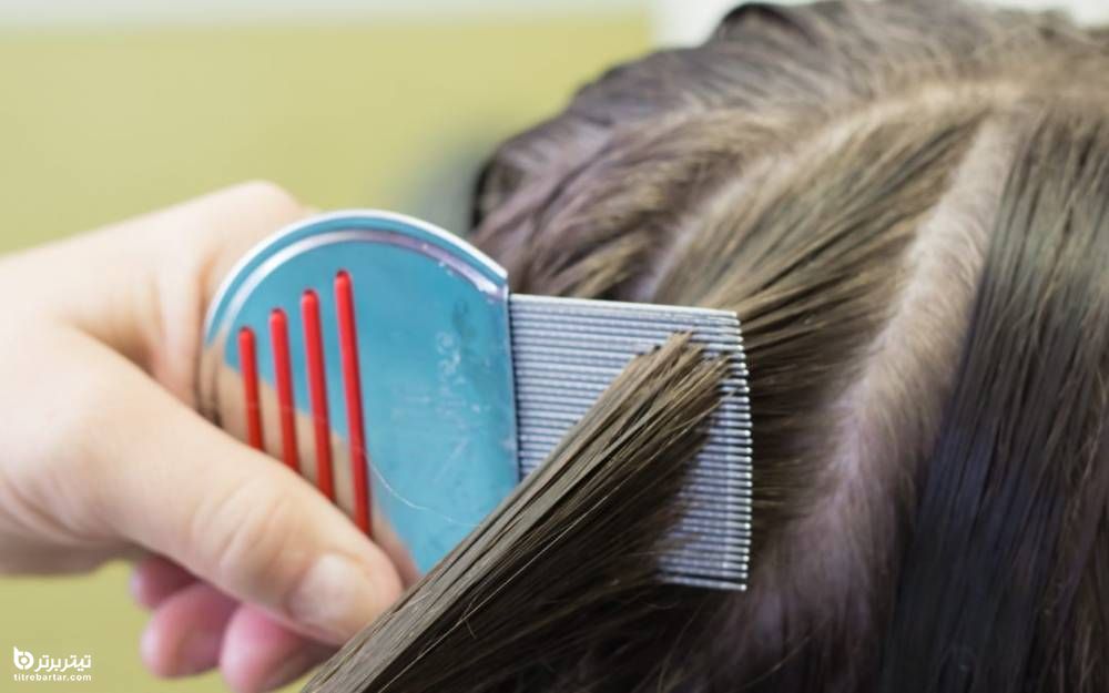 راه های درمان شپش موی سر