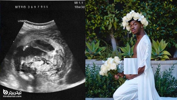 ماجرای حامله شدن لیل ناس خواننده مرد آمریکایی