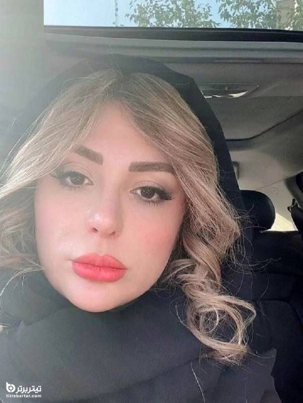 جزئیات عکس نیوشا ضیغمی بعد از عمل زیبایی