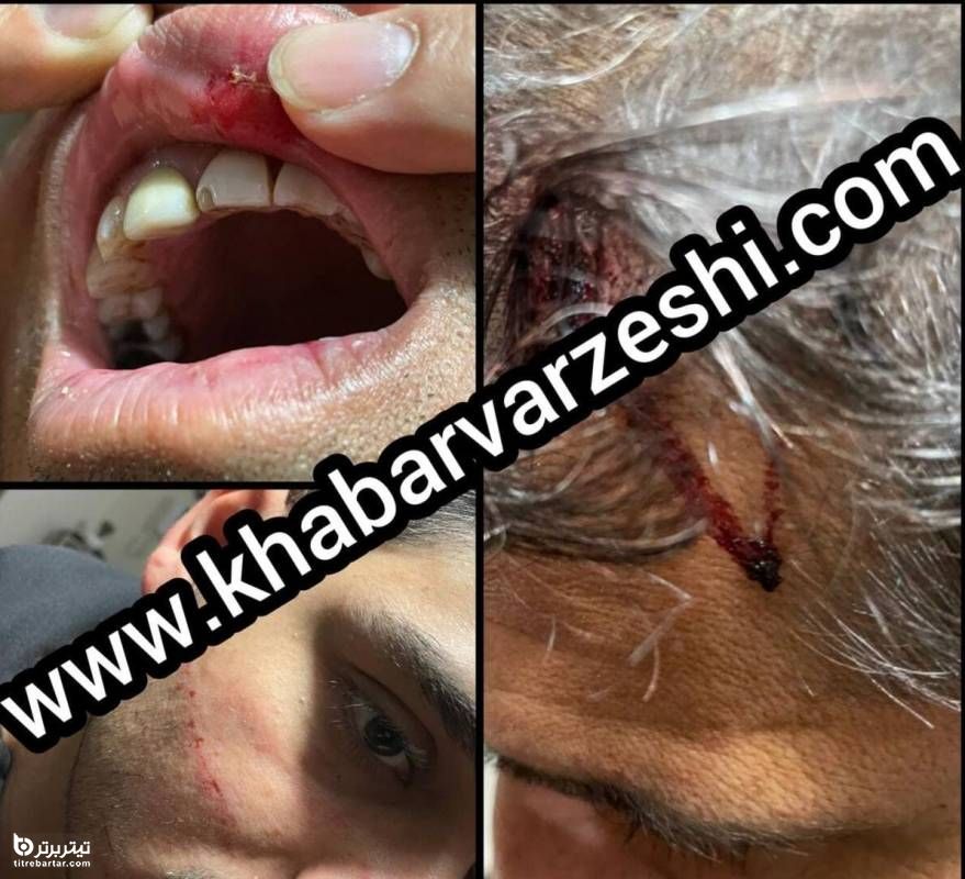 جزئیات ضرب و شتم بهزاد داداش زاده بازیکن فوتبال