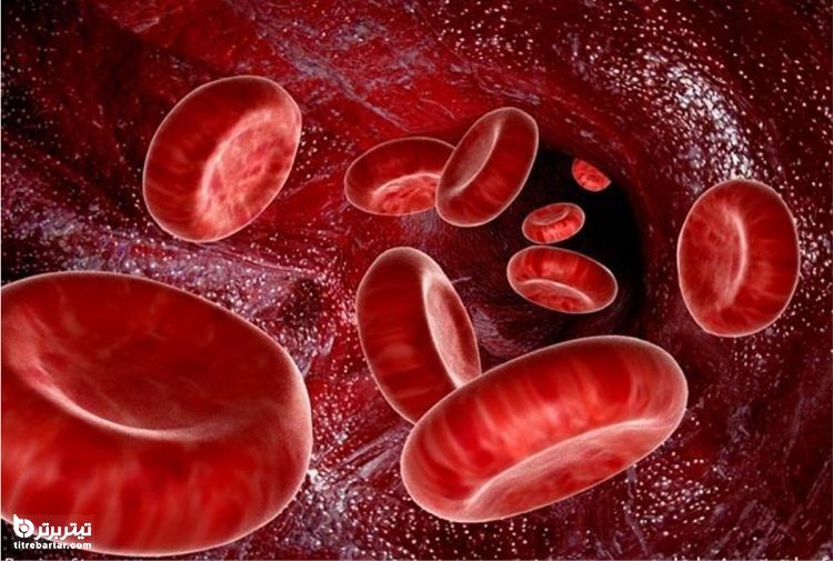 شایع‌ترین علائم کم خونی کدامند؟