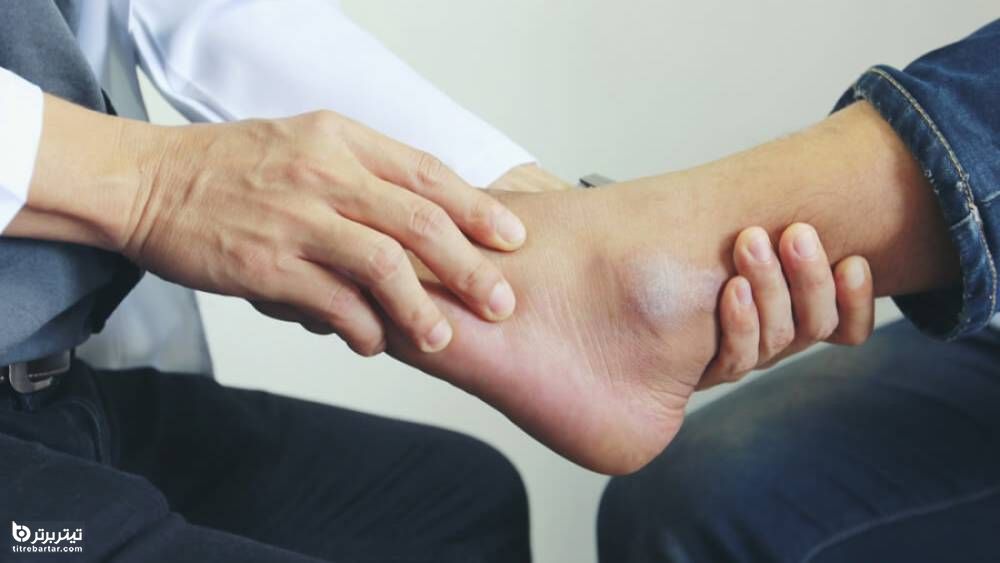 علت درد قوزک پا چیست؟