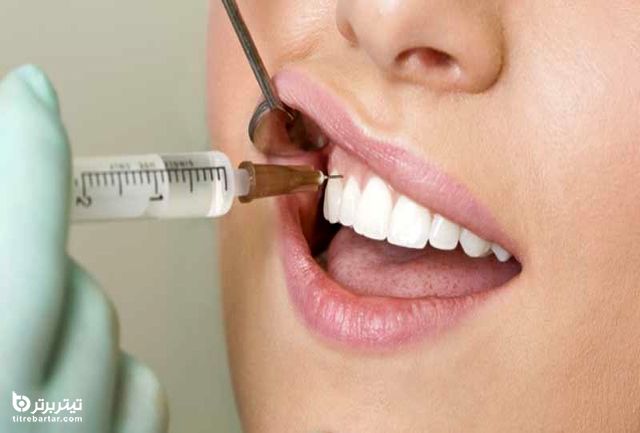 چند نوع آبسه دندانی وجود دارد؟