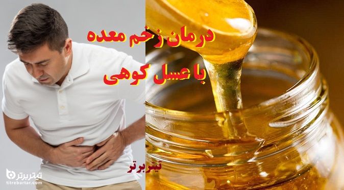 1-درمان زخم معده با عسل کوهی