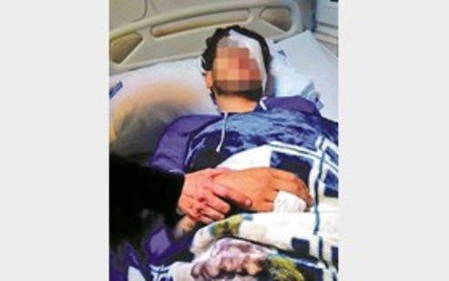 تنبیه معلم دانش آموز را روانه بیمارستان کرد +عکس