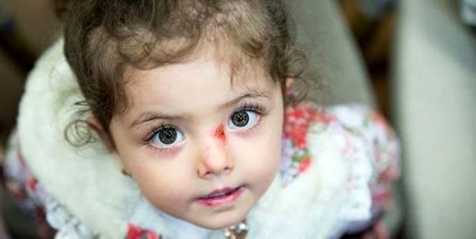 خبرساز شدن مرگ دختر 2 ساله پروانه ای در مجامع بین المللی