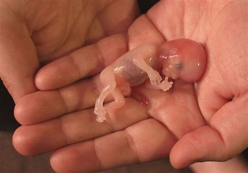 تصویر دیده نشده از سقط جنین خارج از رحم