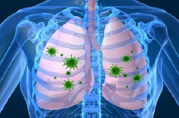 ریه بهبودیافتگان کرونا تا چه زمانی درمان می شود؟