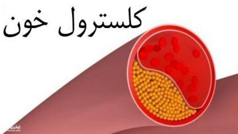 سریع ترین راه کاهش کلسترول خون