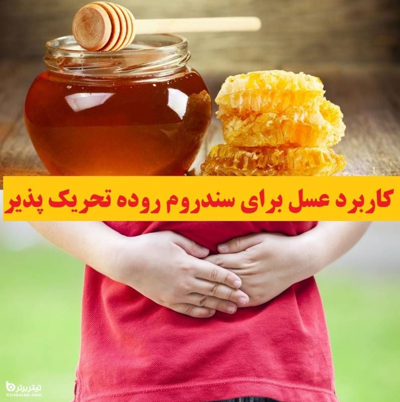 کاربرد عسل برای سندروم روده تحریک پذیر