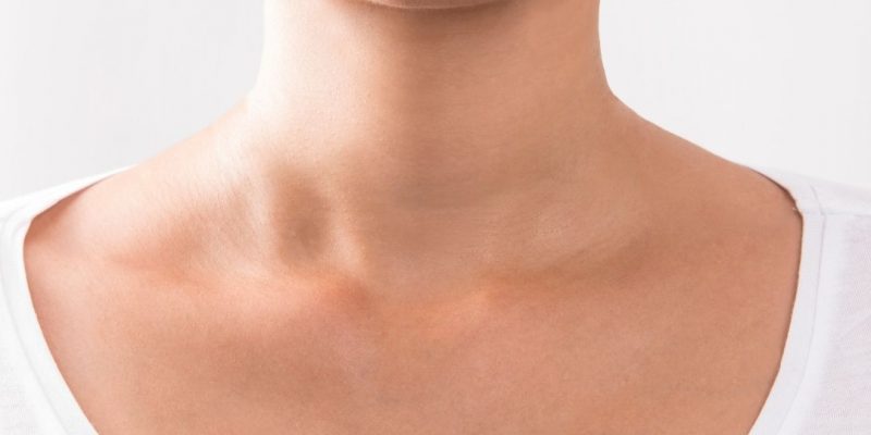 درمان خانگی موثر برای خلاص شدن از شر سیاهی گردن
