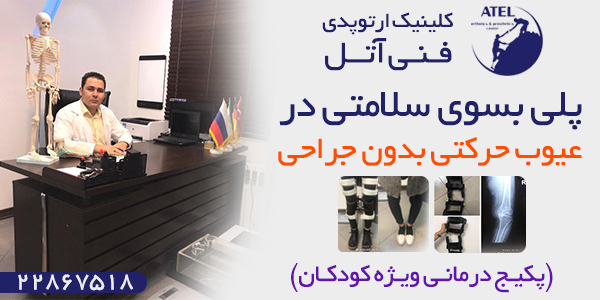 شناخت و درمان پای ایکس و پرانتزی شناخت و درمان پای ایکس و پرانتزی