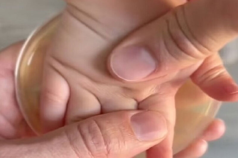  | ویدئویی ترسناک از دورهمی باکتری‌ها در کف دست یک کودک
