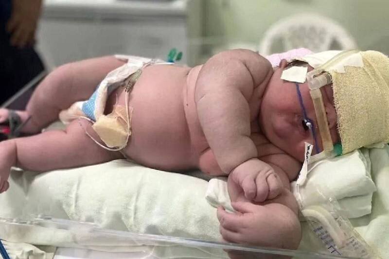  |  به دنیا آمدن سنگین‌ترین نوزاد ایرانی در مشهد