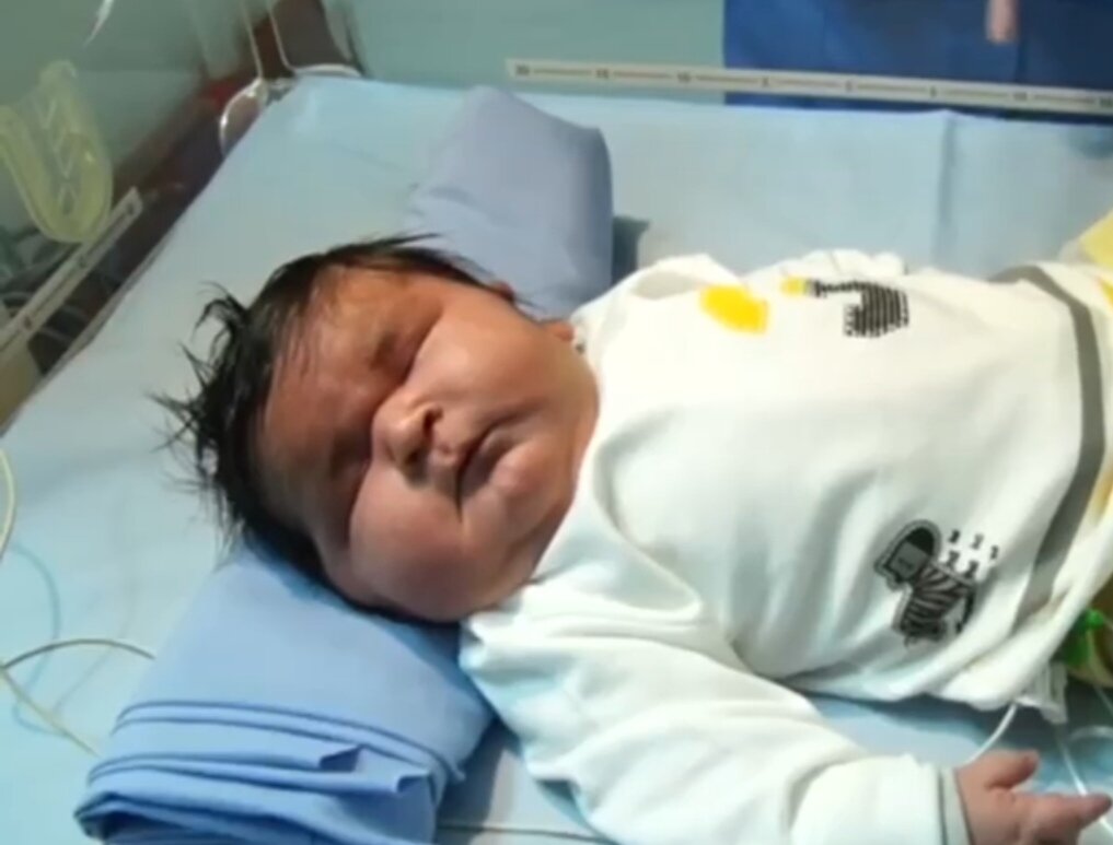 اولین تصاویر از تولد سنگین‌وزن‌ترین نوزاد تاریخ ایران