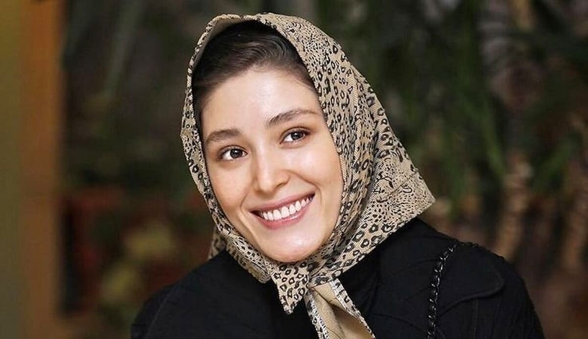 عکس | صورت کبود فرشته حسینی با چشم خونریزی کرده!