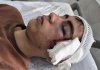 ضربوشتم دانشآموز با دسته صندلی / روایت پدر از خشونت علیه فرزندش در دبیرستان دهبکری بم / آموزشوپرورش وعده پیگیری داد + عکس ضربوشتم دانشآموز با دسته صندلی / روایت پدر از خشونت علیه فرزندش در دبیرستان دهبکری بم / آموزشوپرورش وعده پیگیری داد + عکس
