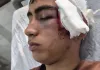 ورود دادستانی بم به پرونده تنبیه بدنی دانشآموز در دهبکری + عکس ورود دادستانی بم به پرونده تنبیه بدنی دانشآموز در دهبکری + عکس