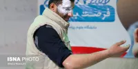 تصاویر | عکس‌های تلخ از مصدومان حادثه چهارشنبه‌سوری