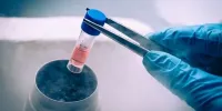 آنچه زنان باید درباره «فریز تخمک» بدانند/ تخمک فریزشده تا چه زمان ماندگاری دارد؟