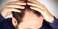 اگر رشد موهایتان کُند است، این روغن را بزنید