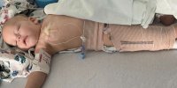 دوربین مانیتور راز سرطان کودک را فاش کرد | چگونه فناوری به کمک آمد؟