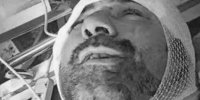 اولین فیلم لحظه تیر خوردن هانی کرده | ببینید