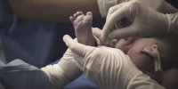 عمل بی سابقه و نادر سزارین مادر ۱۸۵ کیلویی در شهرکرد