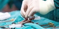 خارج کردن توده ۴ کیلوگرمی از شکم دختر ۱۸ ساله/ عکس