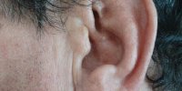 چند توصیه برای باز کردن گرفتگی گوش