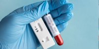 کیت تشخیص سریع HIV بومی‌سازی‌ می‌شود